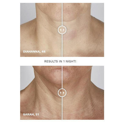 SiO NeckLift